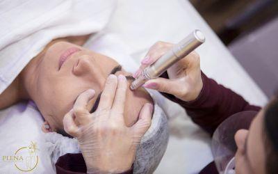 CONTROLE DE ACNE/OLEOSIDADE